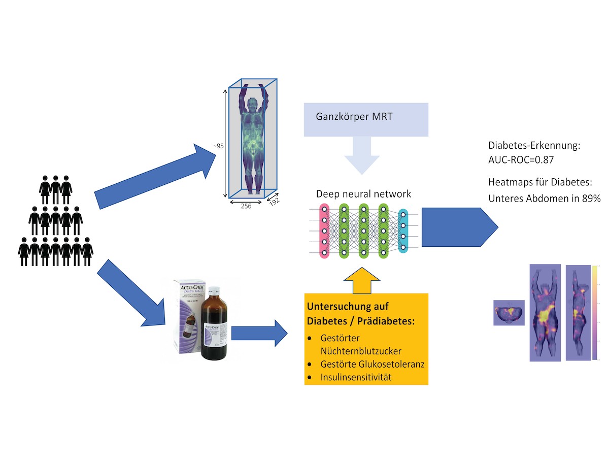 Detect diabetes with whole-body MRI